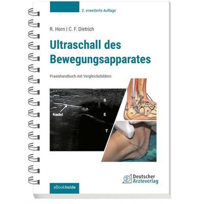 Ultraschall des Bewegungsapparates, Set von Rudolf Horn,Christoph F. Dietrich, Deutscher Ärzteverlag, 978-3-7691-3864-1