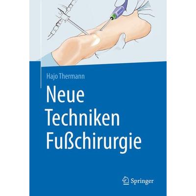 Neue Techniken Fußchirurgie, Gebundene Ausgabe von Hajo Thermann, Springer Berlin, 978-3-662-52736-8
