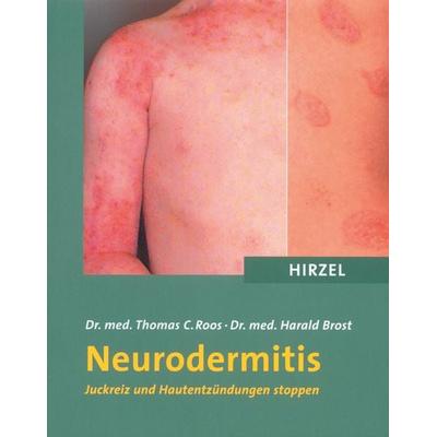 Neurodermitis, Taschenbuch von Thomas C. Roos,Harald Brost, S. Hirzel Verlag, 978-3-7776-1263-8