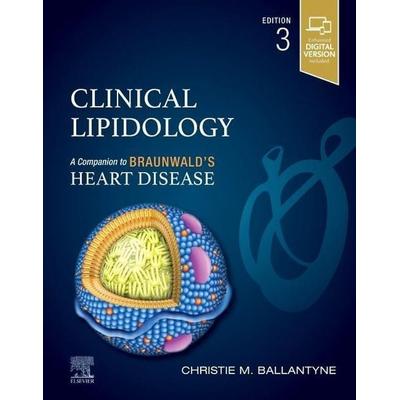 Clinical Lipidology, Gebundene Ausgabe von Christie M. Ballantyne, Elsevier, 978-0-323-88286-6