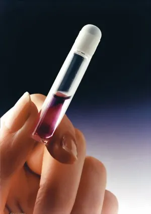 Ethicon DERMABOND HVD Hautkleber, 6 x 0,5 ml Ampullen AHV6