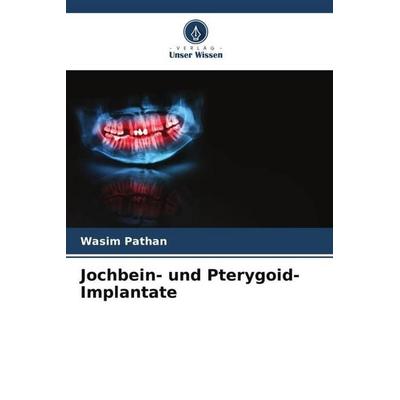 Jochbein- und Pterygoid-Implantate, Taschenbuch von Wasim Pathan, Verlag Unser Wissen, 978-620-5-16481-5