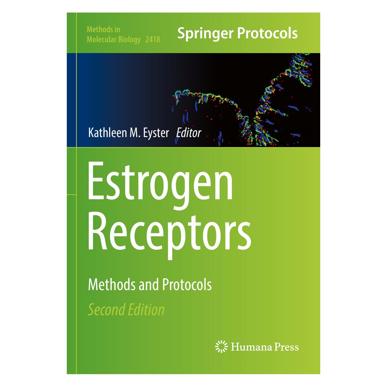 Springer Estrogen Receptors (Englisch, Softcover, Kathleen M. Eyster) (56929295)