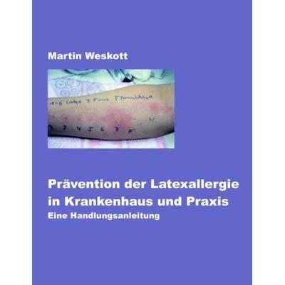 Prävention der Latexallergie in Krankenhaus und Praxis, Taschenbuch von Martin Weskott, BoD – Books on Demand, 978-3-8311-3732-9