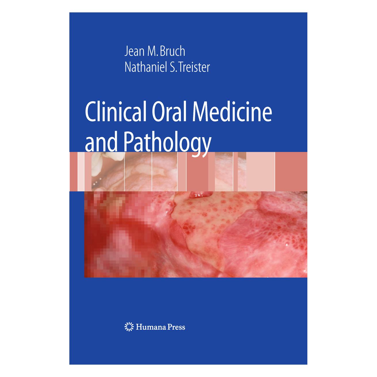 Springer Clinical Oral Medicine and Pathology (Englisch, Softcover, Jean M. Bruch, Nathaniel Treister) (55964771)