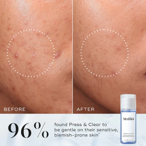 Medik8 Press&Clear Tónico Exfoliante com 2% BHA 150ml
