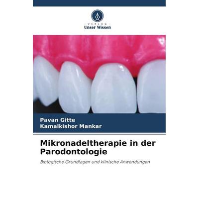 Mikronadeltherapie in der Parodontologie, Taschenbuch von Pavan Gitte,Kamalkishor Mankar, Verlag Unser Wissen