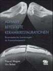 Pascal Magne - Adhäsiv befestigte Keramikrestaurationen: Biomimetische Sanierungen im Frontzahnbereich - Preis vom 10.10.2026 11:48:34 h