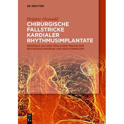 Chirurgische Fallstricke kardialer Rhythmusimplantate, Taschenbuch von Brigitte Osswald, De Gruyter, 978-3-11-063696-3