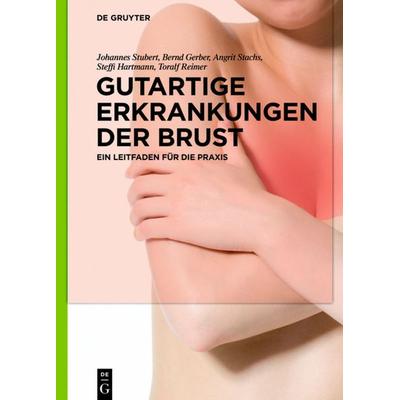 Gutartige Erkrankungen der Brust, Gebundene Ausgabe von Johannes Stubert,Bernd Gerber,Angrit Stachs,Steffi Hartmann,Toralf Reimer, De Gruyter,