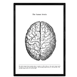 POSTER Anatomie Gehirn A4 Rahmenlos