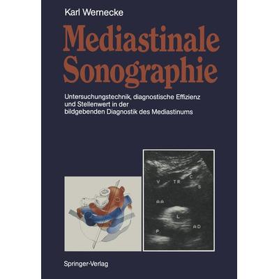 Mediastinale Sonographie, Taschenbuch von Karl Wernecke, Springer Berlin, 978-3-642-75849-2
