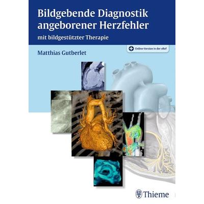 Bildgebende Diagnostik angeborener Herzfehler, Set von Matthias Gutberlet, Thieme, 978-3-13-146061-5