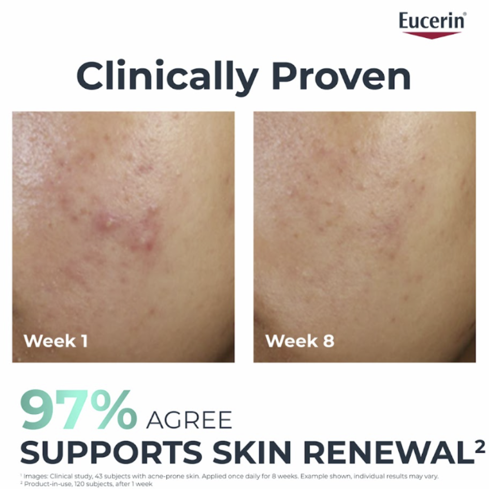 Eucerin Dermopure Clinical Mattifying Fluid Blemish-Prone Skin 40mL