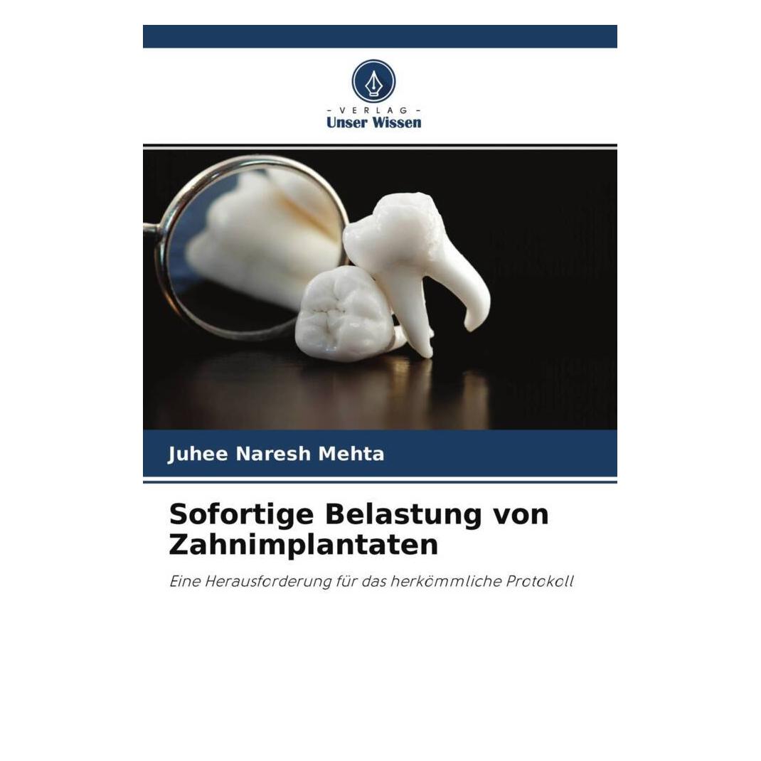 Unser Wissen Sofortige Belastung von Zahnimplantaten (56848331)
