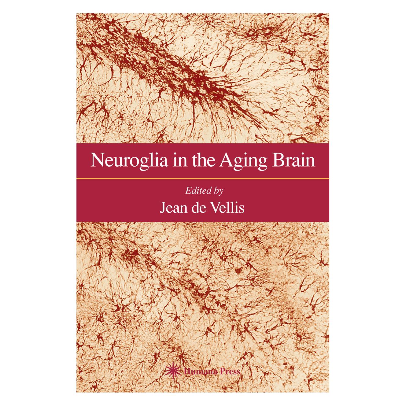 Springer Neuroglia in the Aging Brain (Englisch, Softcover, Jean de Vellis) (55382444)