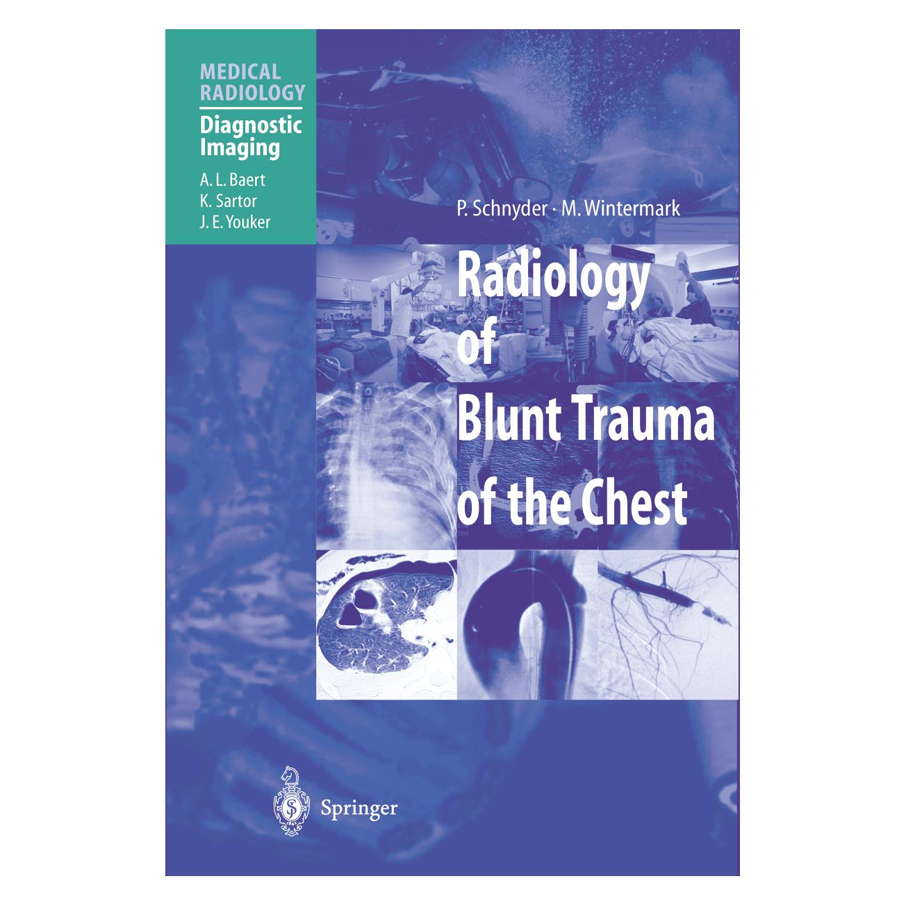 Springer Radiology of Blunt Trauma of the Chest (Englisch, Softcover, M. Wintermark, P. Schnyder) (55538578)