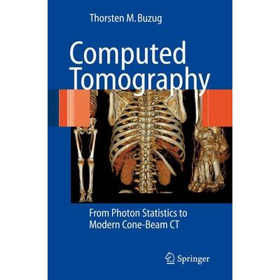 Computed Tomography, Taschenbuch von Thorsten M. Buzug, Springer Berlin, 978-3-642-07257-4