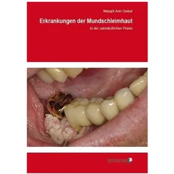 Erkrankungen der Mundschleimhaut, Fachbücher von Margrit-Ann Geibel