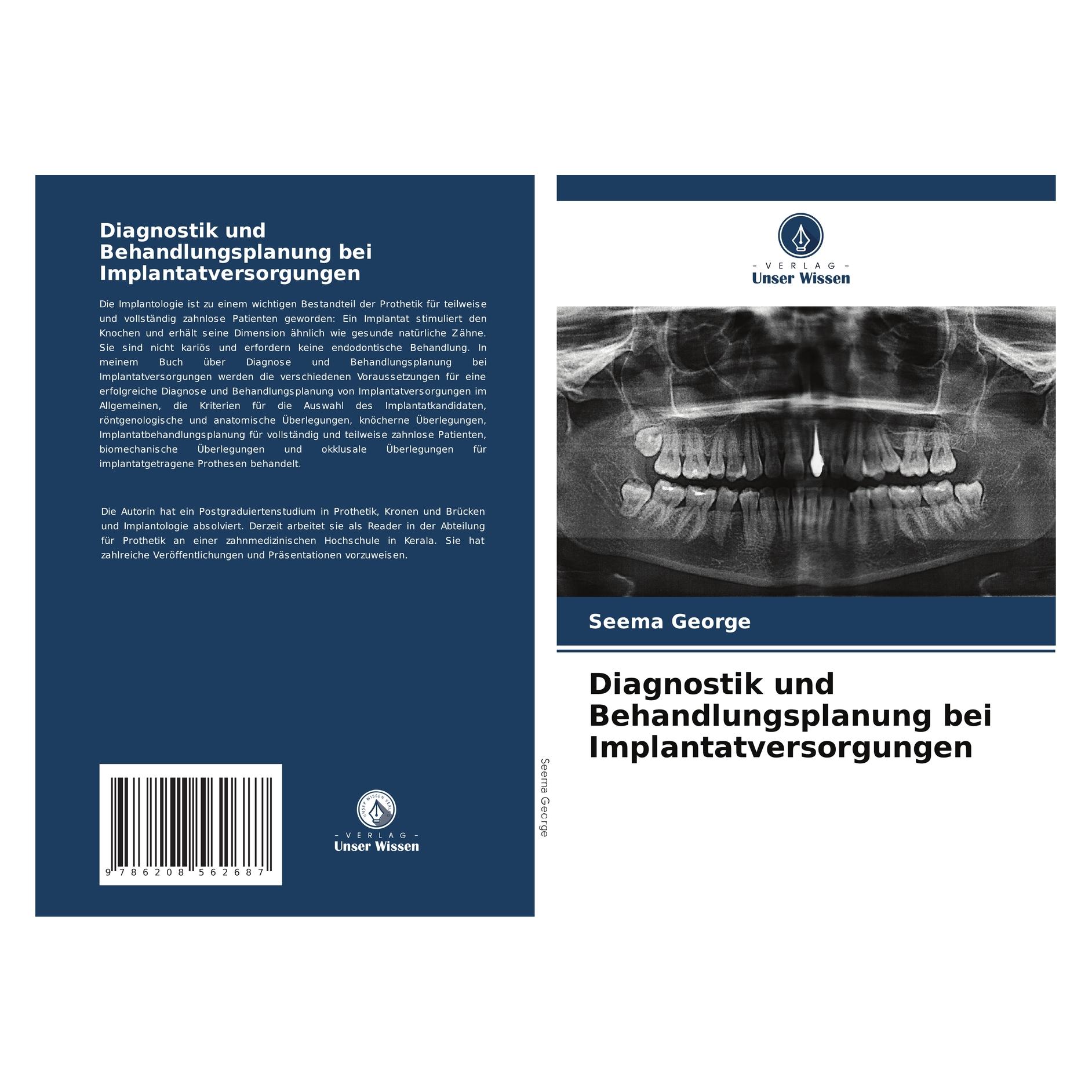 Bod Diagnostik und Behandlungsplanung bei Implantatversorgungen (Deutsch, Softcover, Seema George) (57194735)