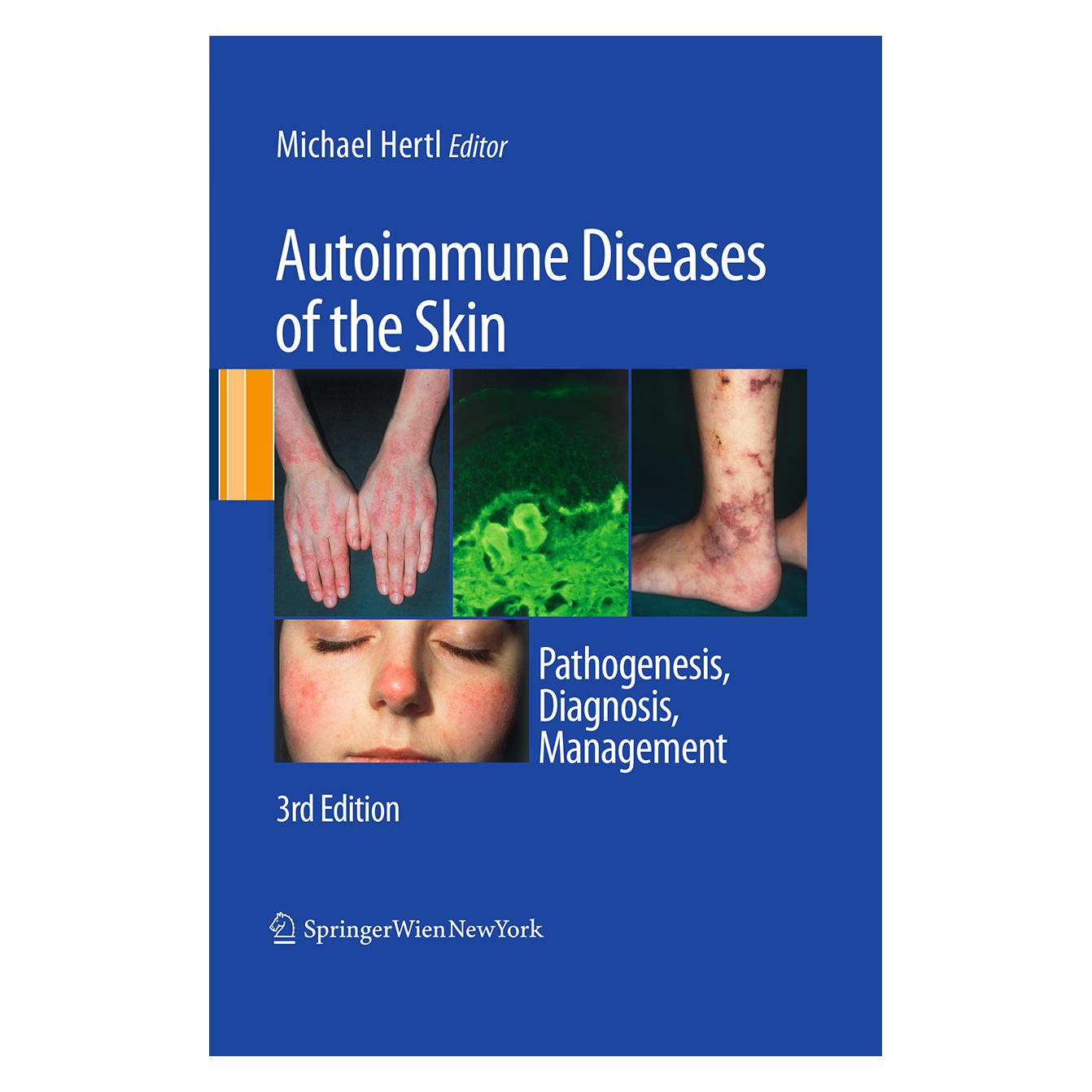 Springer Autoimmune Diseases of the Skin (Englisch, Softcover, Michael Hertl) (55948858)