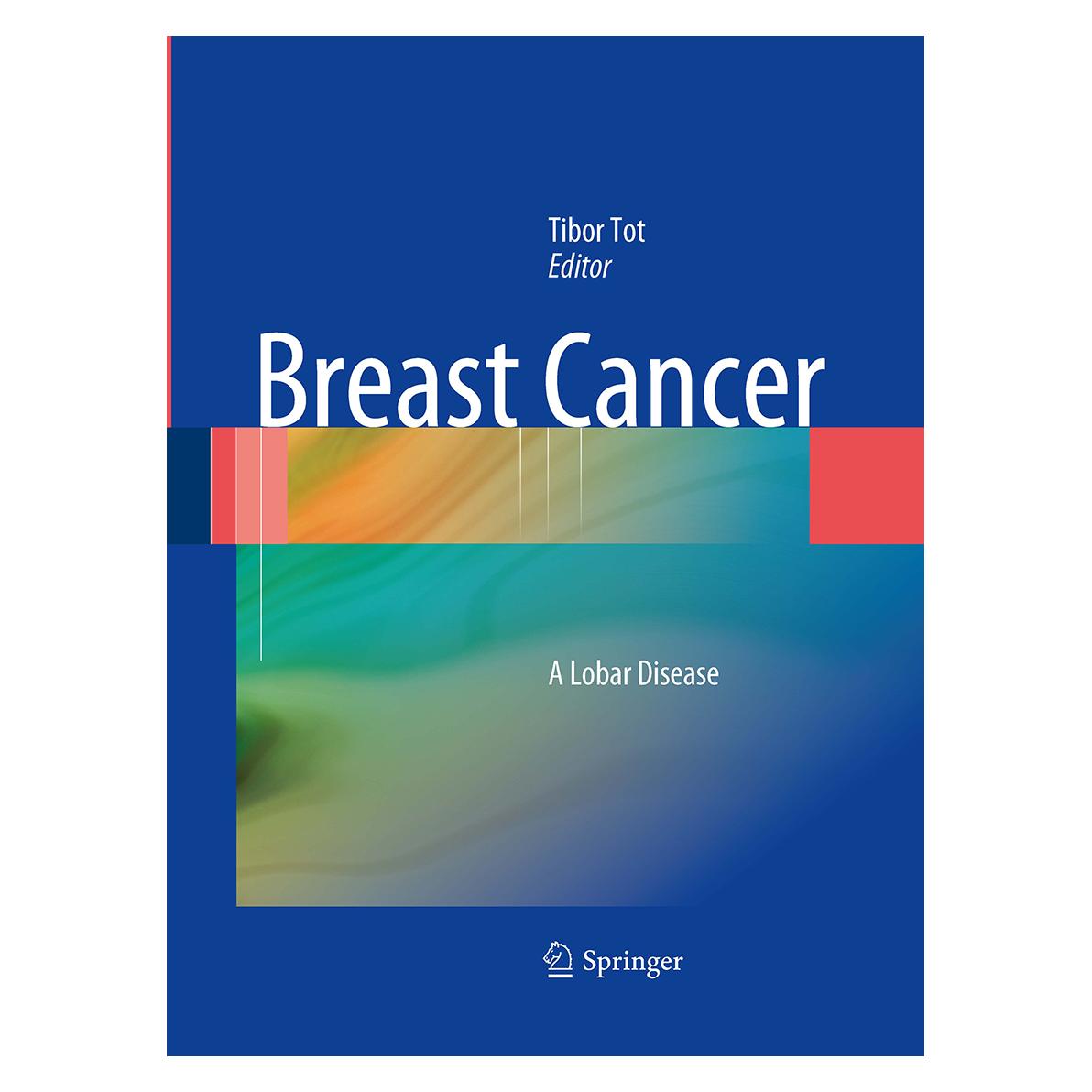 Springer Breast Cancer (Englisch, Softcover, Tibor Tot) (55966672)