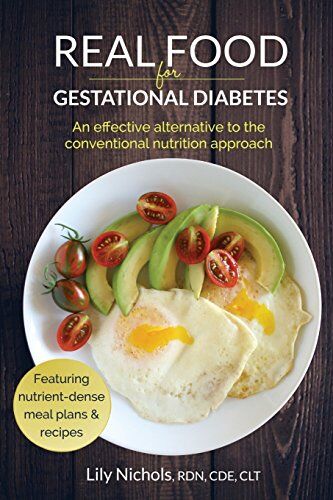 Lily Nichols - Real Food for Gestational Diabetes: An Effective Alternative to the Conventional Nutrition Approach - Preis vom 01.10.2026 17:08:56 h