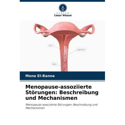Menopause-assoziierte Störungen: Beschreibung und Mechanismen, Taschenbuch von Mona El-Banna, Verlag Unser Wissen, 978-620-8-80199-1