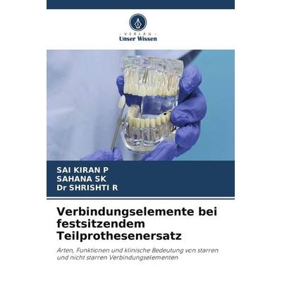 Verbindungselemente bei festsitzendem Teilprothesenersatz, Taschenbuch von Sai Kiran P.,Sahana Sk,Shrishti R., Verlag Unser Wissen