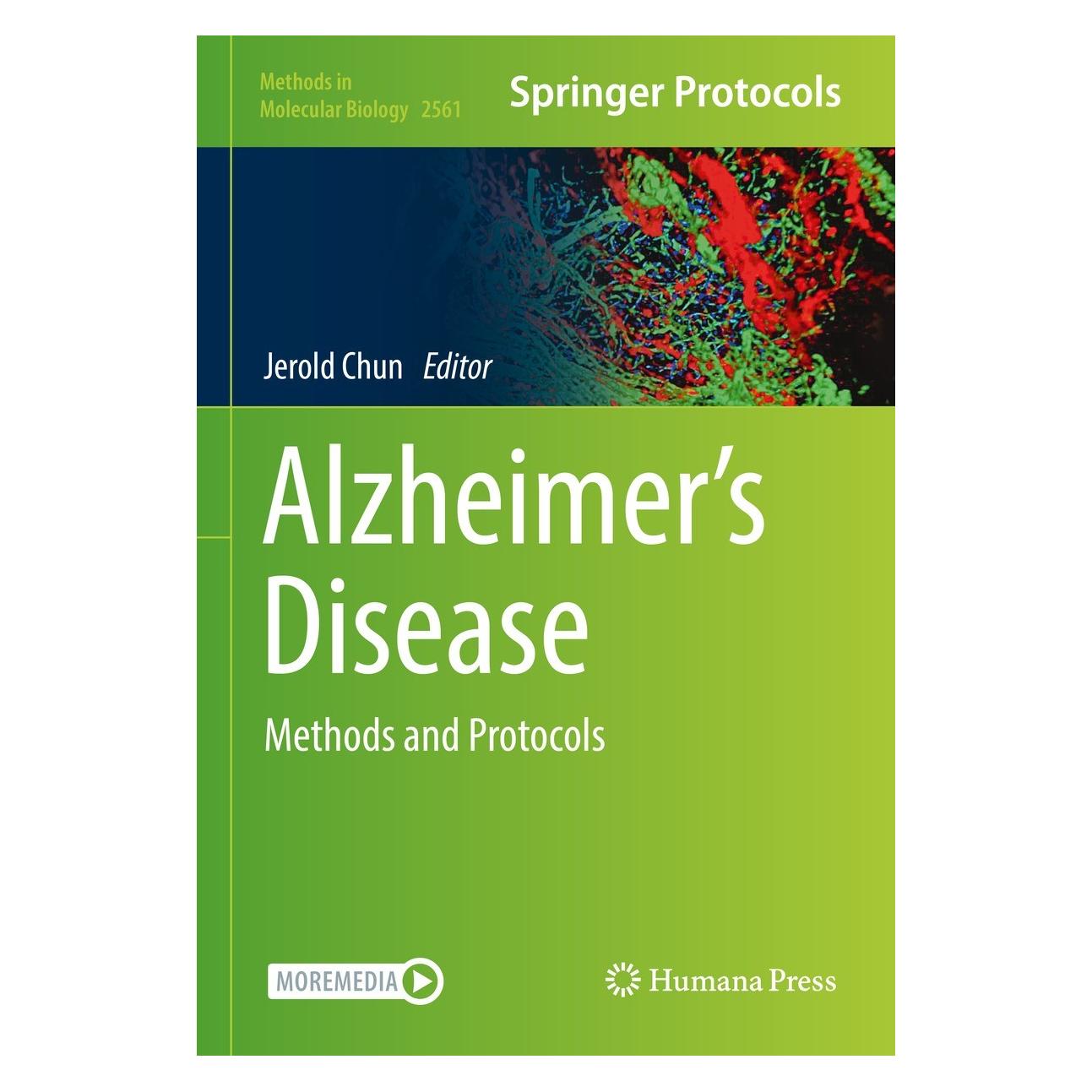 Springer Alzheimer's Disease (Englisch, Hardcover, Jerold Chun) (9781071626542)