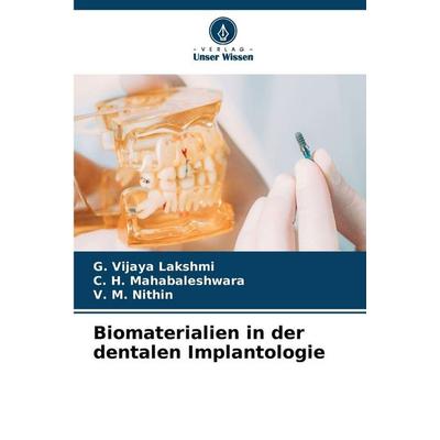 Biomaterialien in der dentalen Implantologie, Taschenbuch von G. Vijaya Lakshmi,C. H. Mahabaleshwara,V. M. Nithin, Verlag Unser Wissen,