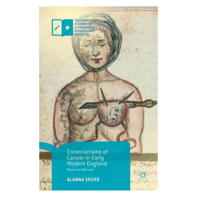 Palgrave Macmillan Uk Skuse:Constructions of Cancer in Early (Englisch, Hardcover, Alanna Skuse) (63339967)