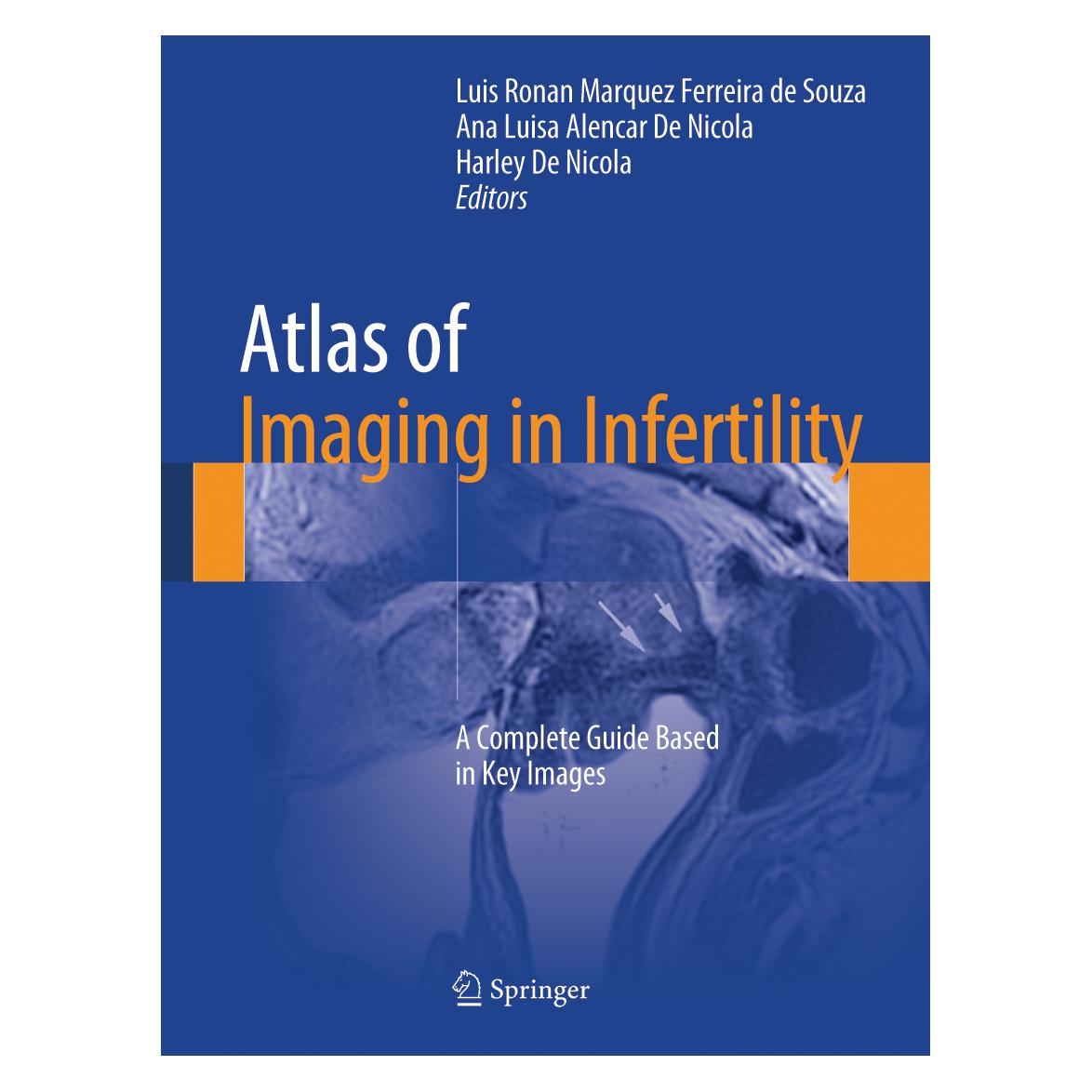Springer Atlas of Imaging in Infertility (Englisch, Hardcover, Ana Luisa Alencar De Nicola, Harley De Nicola, Luis Ronan Marquez Ferreira de Souza) (9783319138923)