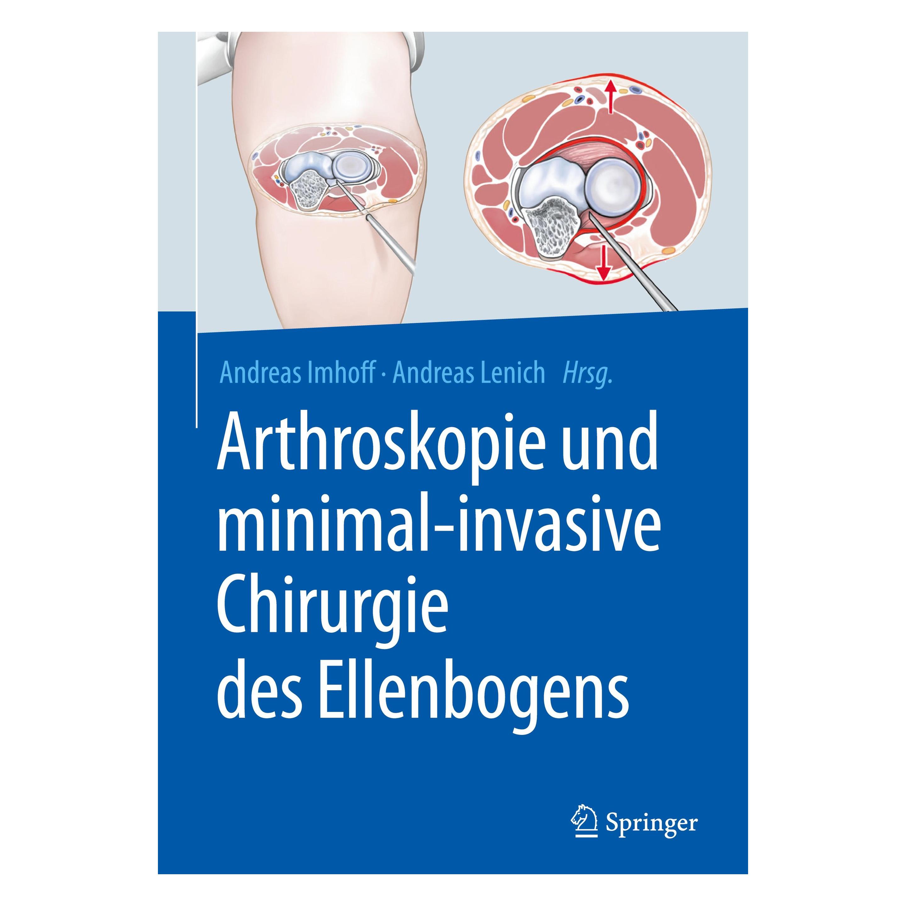 Springer Arthroskopie und minimal-invasive Chirurgie des Ellenbogens (Deutsch, Hardcover, Andreas B. Imhoff, Andreas Lenich) (9783662566787)