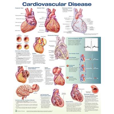 Cardiovascular Disease Anatomical Chart, Nonbook von Anatomical Chart Company Acc, Ingram Publishers Services, 978-1-4963-6979-6