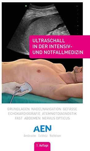Wolf Armbruster - Ultraschall in der Intensiv- und Notfallmedizin: Grundlagen, Nadelnavigation, Gefäße, Echokardiografie, Atemnotdiagnostik, FAST, Abdomen, Nervus opticus - Preis vom 15.10.2026 23:06:25 h