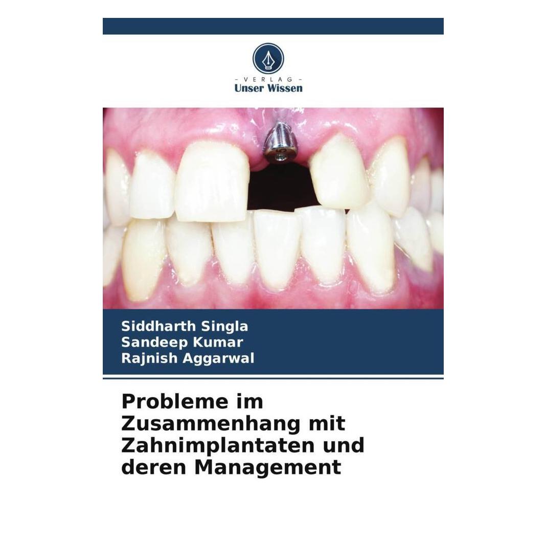 Unser Wissen Probleme im Zusammenhang mit Zahnimplantaten und deren Management (56889673)
