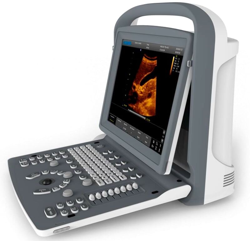 Ecógrafo Portátil Chison ECO2