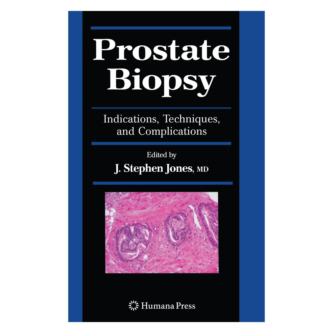 Humana Press Prostate Biopsy (Englisch, Hardcover, J. Stephen Jones) (9781588297907)