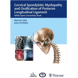 Cervical Spondylotic Myelopathy and Oss, Fachbücher von Mehmet Zileli, J K B C Parthiban