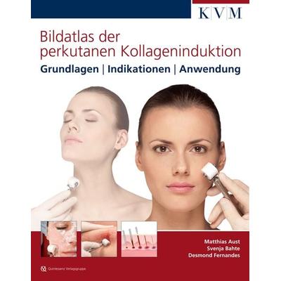 Bildatlas der perkutanen Kollageninduktion, Gebundene Ausgabe von Matthias Aust,Svenja-Katharina Bahte,Desmond Fernandez, KVM - Der Medizinverlag,