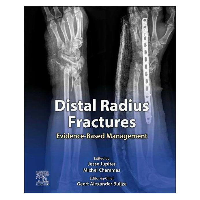 Elsevier Distal Radius Fractures (Englisch, Geert Alexander Buijze, Jesse Jupiter, Michel Chammas, 2021) (42039725)