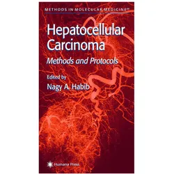 Hepatocellular Carcinoma, Fachbücher von Nagy A. Habib, A Habib