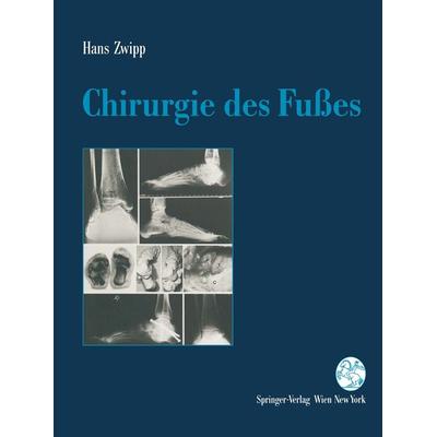 Chirurgie des Fußes, Taschenbuch von Hans Zwipp, Springer Wien, 978-3-7091-7366-4