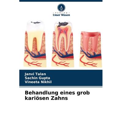 Behandlung eines grob kariösen Zahns, Taschenbuch von Janvi Talan,Sachin Gupta,Vineeta Nikhil, Verlag Unser Wissen, 978-620-7-76678-9