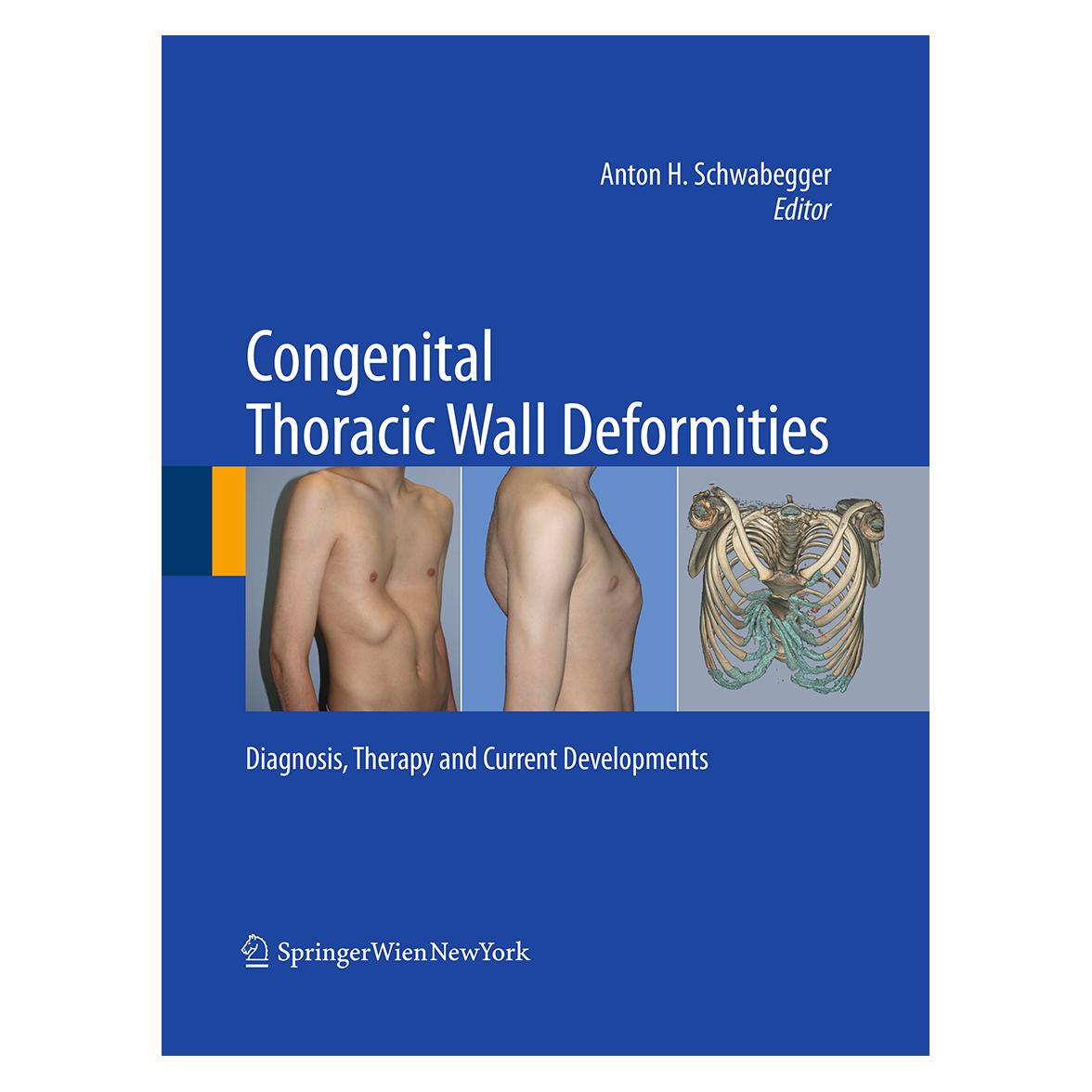 Springer Congenital Thoracic Wall Deformities (Englisch, Softcover, Anton H. Schwabegger) (55948122)