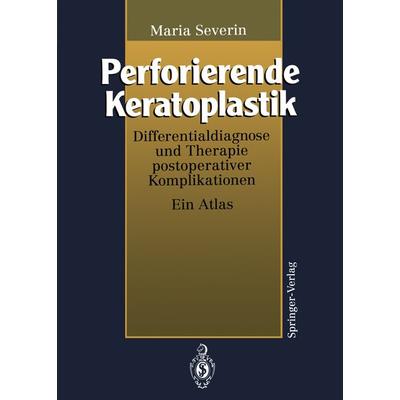 Perforierende Keratoplastik, Taschenbuch von Maria Severin, Springer Berlin, 978-3-642-79007-2
