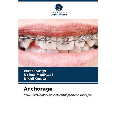 Anchorage, Taschenbuch von Mansi Singh,Dolma Madhwal,Nikhil Gupta, Verlag Unser Wissen, 978-620-6-60715-1
