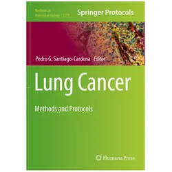 Lung Cancer, Fachbücher von Pedro G. Santiago-Cardona