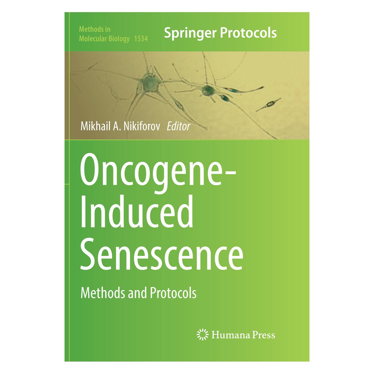 Springer Oncogene-Induced Senescence (Englisch, Softcover, Mikhail A. Nikiforov) (56005042)